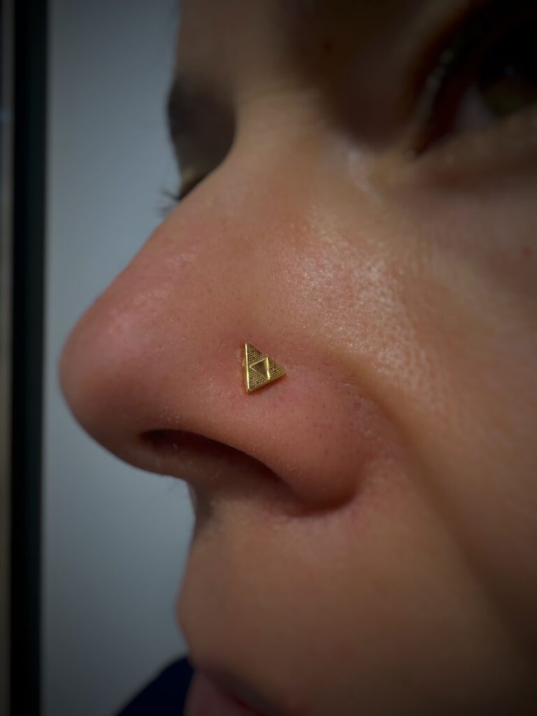 Oreja con piercing en proceso de cicatrización normal