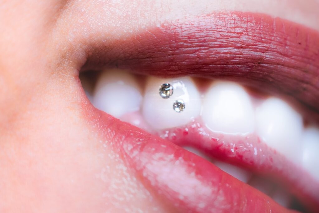 Cómo se coloca una gema dental y qué cuidados necesita