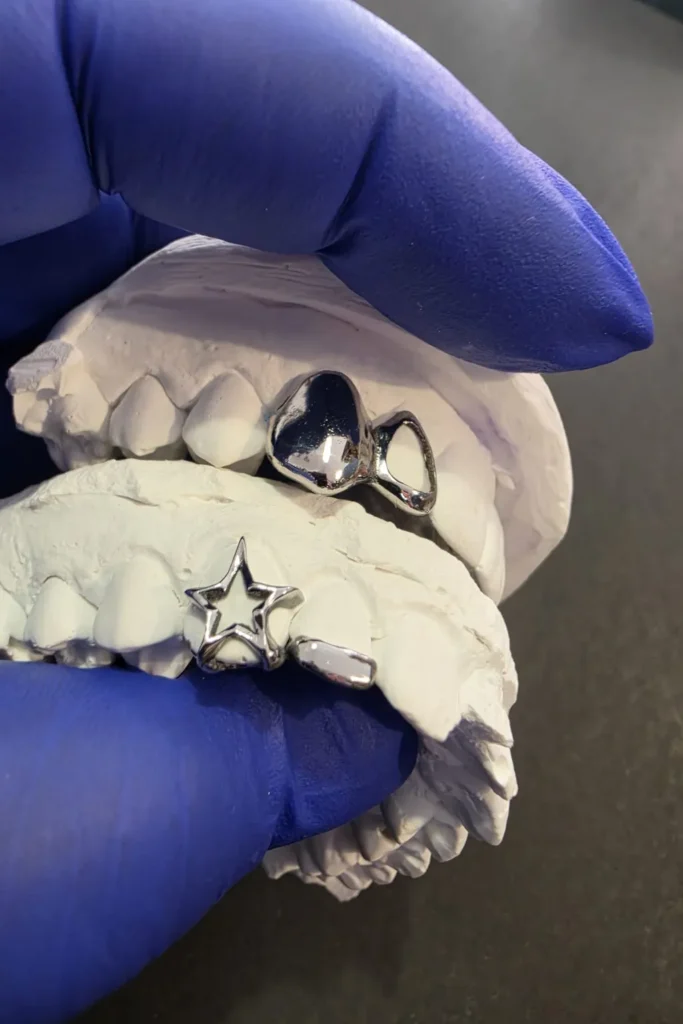 Grillz en Tenerife: tipos, ajuste, higiene y cuidados